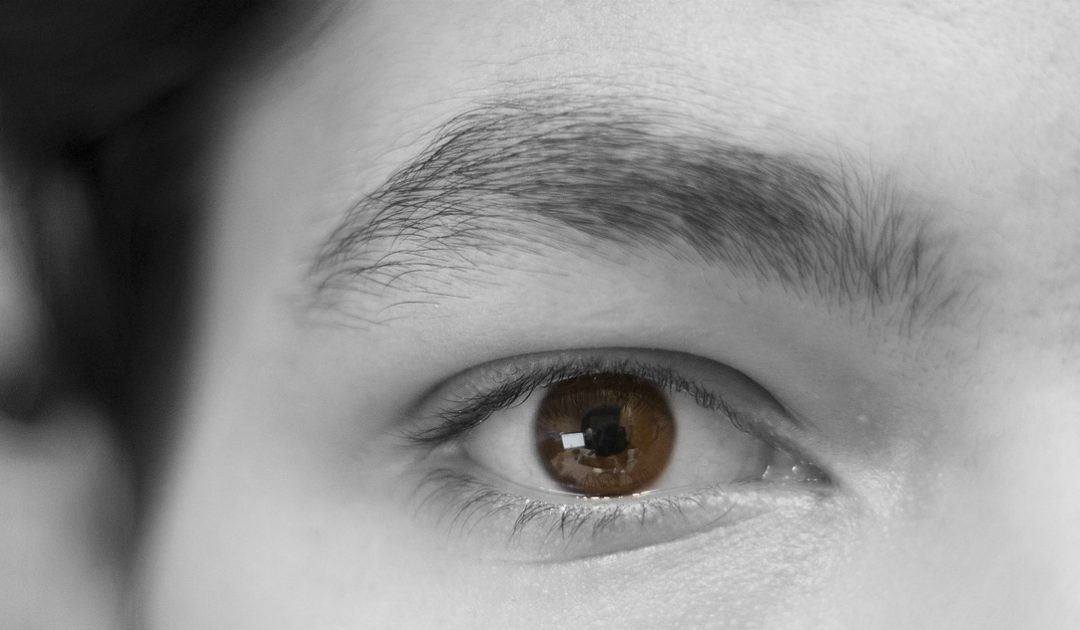 Dermatite atopica, una malattia non solo pediatrica