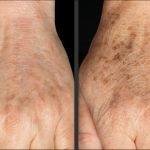 COVID-19 e invecchiamento della pelle: quale relazione?