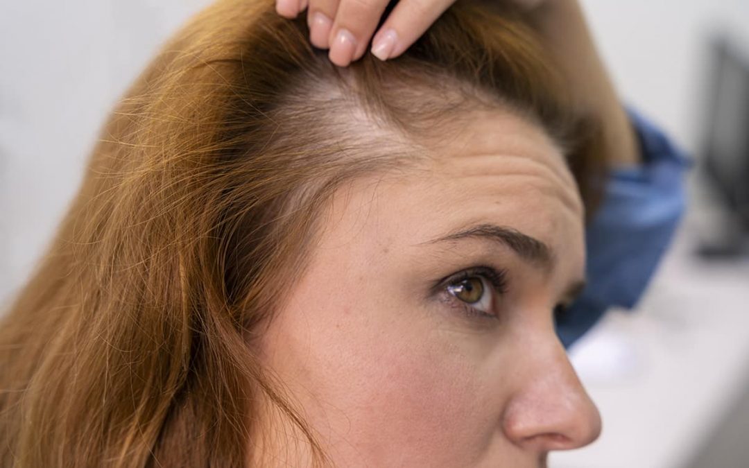 Integratori per capelli: servono davvero?